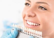 Sbiancamento denti costo: qual è il rimedio più economico?